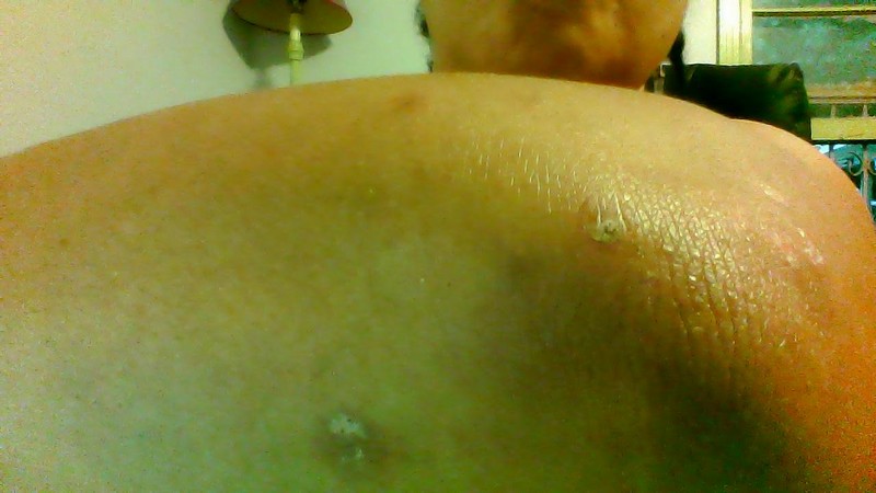 District Of Columbia Bed Bug Hotel and Apartment Reports