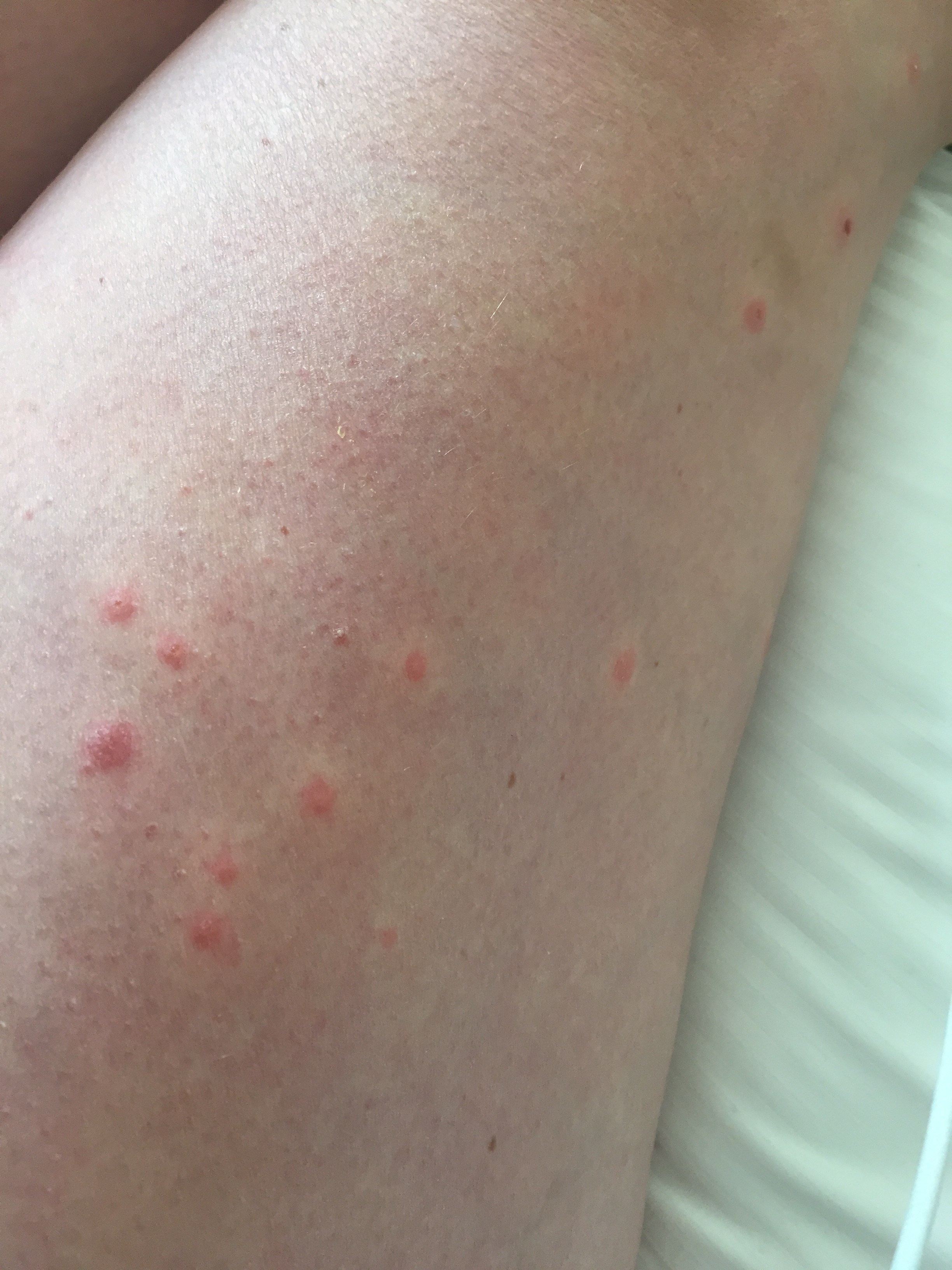 Chicago IL Bed bug Hotel and Apartment Reports