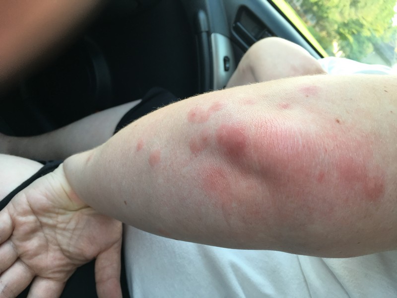 Rehoboth Beach DE Bed bug Hotel and Apartment Reports