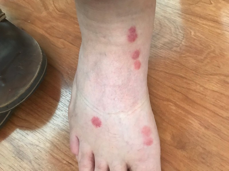 Arizona Bed Bug Hotel and Apartment Reports