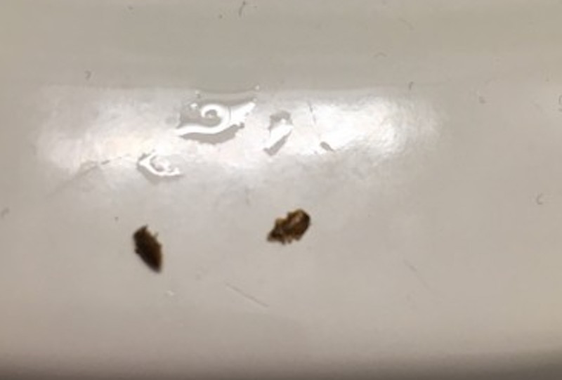 Wisconsin Bed Bug Hotel and Apartment Reports