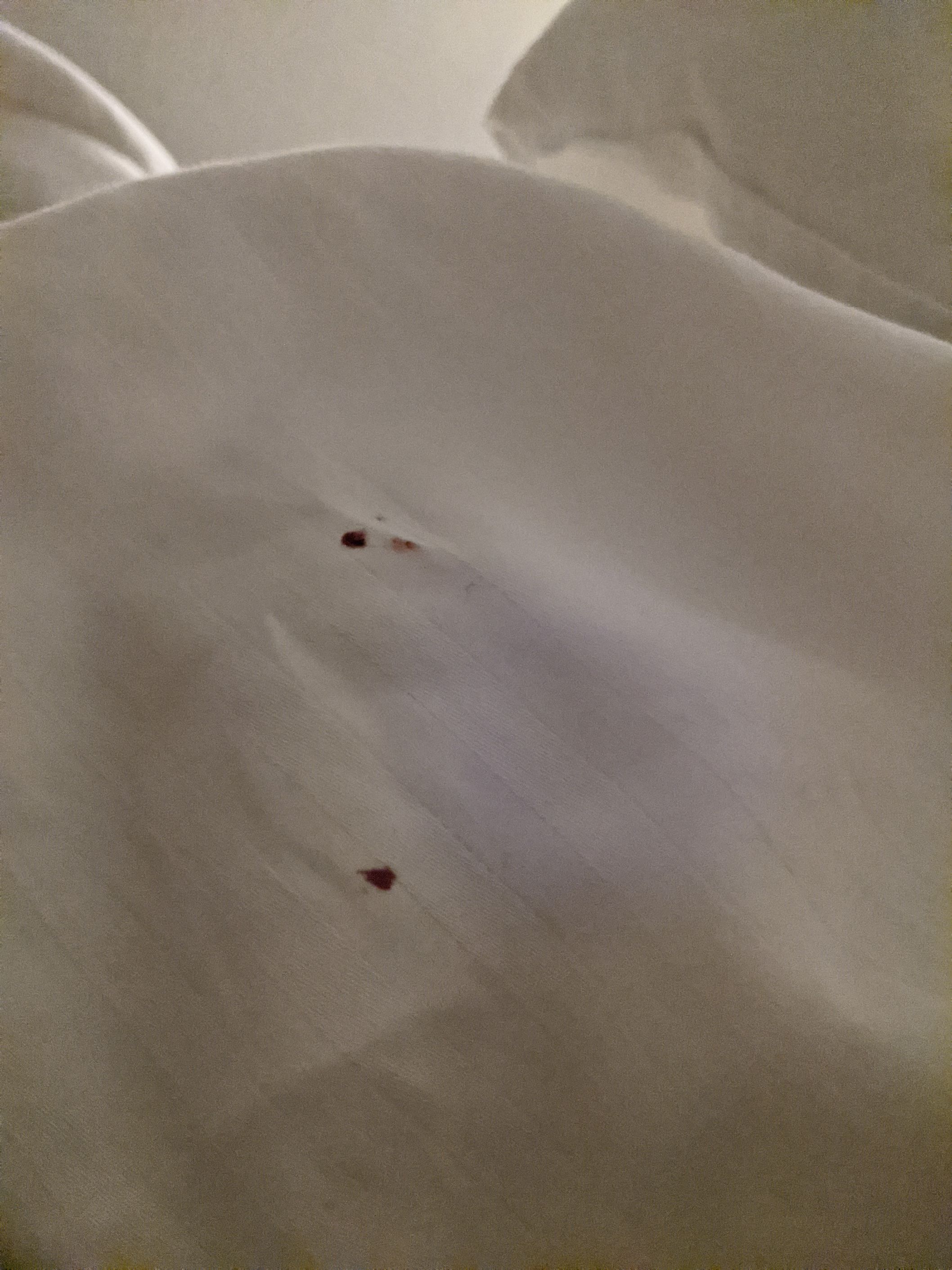 Bed Bug Reports Check Hotels and Apartments Before You Stay