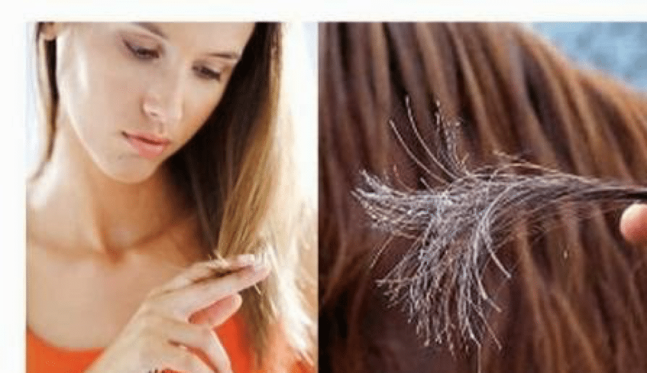 Hair loss after rebonding, side effects, treatment for damaged