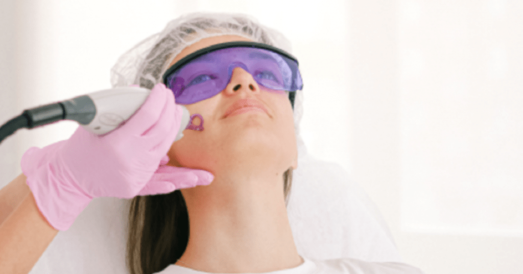 Procedure of The Week Pulsed Dye Laser Beeson Cosmetic Surgery