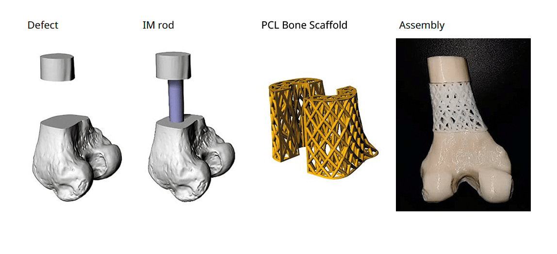 PCL Bone Scaffold Bellaseno Restoring health