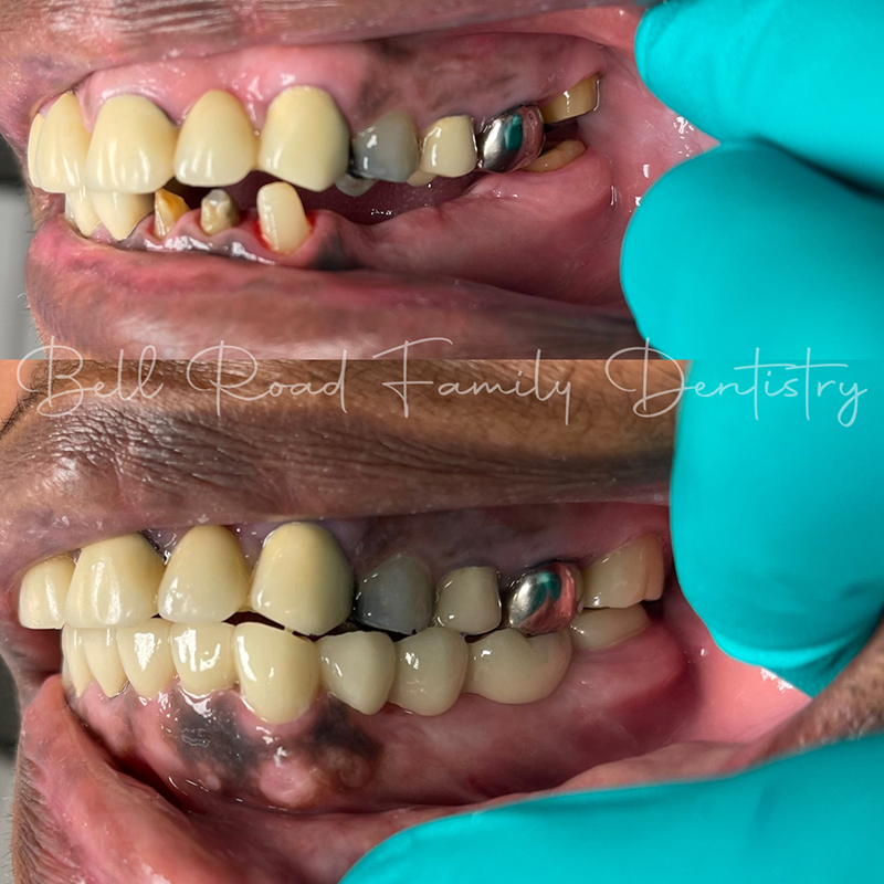 Dentist in Montgomery, AL Dentist Office Near You