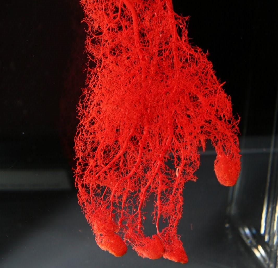 microcapillaries5 Bentley Baths