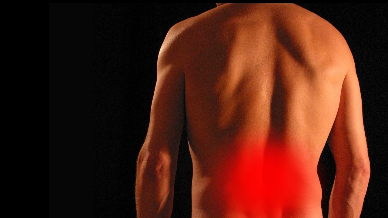 Chronic Low Back Pain Multifidus Weakness React Physical Therapy