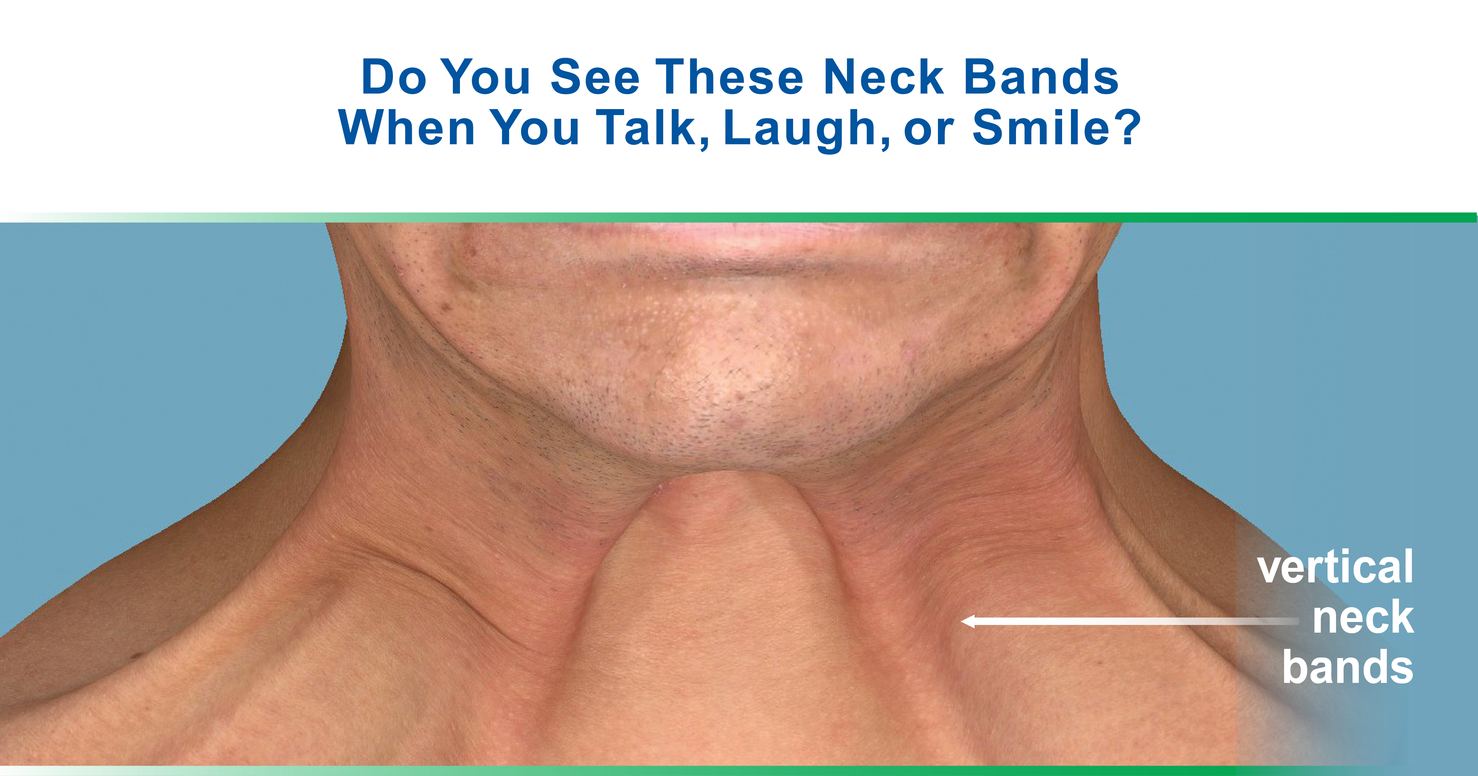 A Phase 3 Multicenter, Randomized, Doubleblind, Placebocontrolled