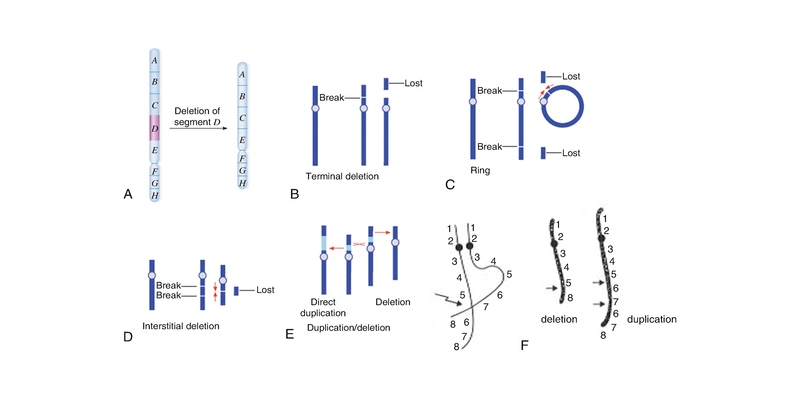 Change In The Structure Of The Chromosome Trivia Quiz BestFunQuiz
