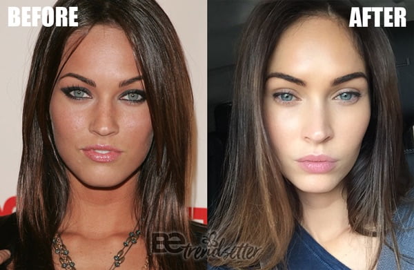 Megan Fox Plastic Surgery Before And After REVEALED! 2019