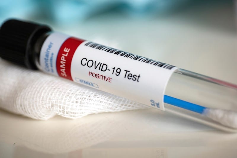COVID 19 Tests Now Available in Bangkok and Chiang Mai BeWell