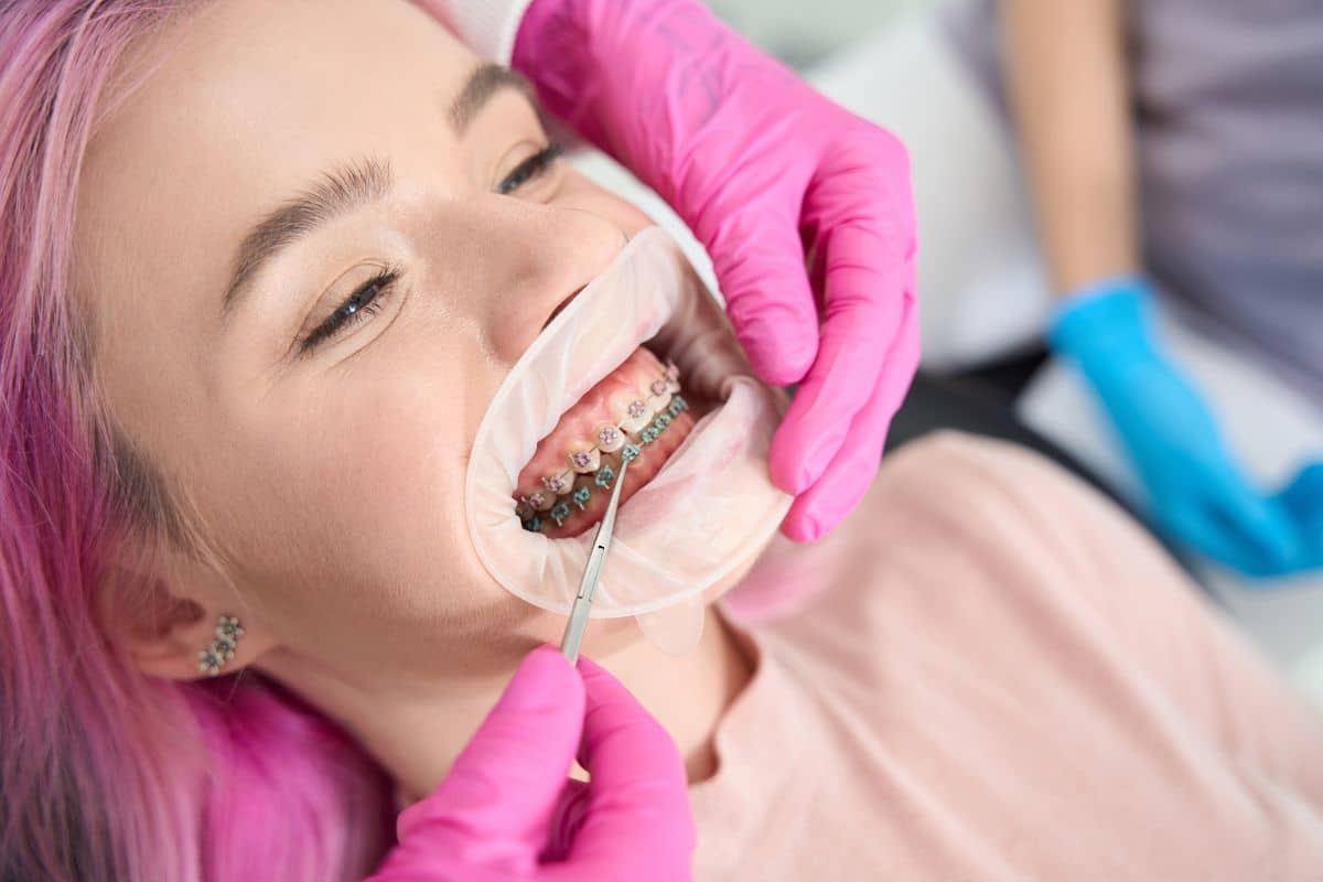 What to Expect When Your Braces Are Removed?