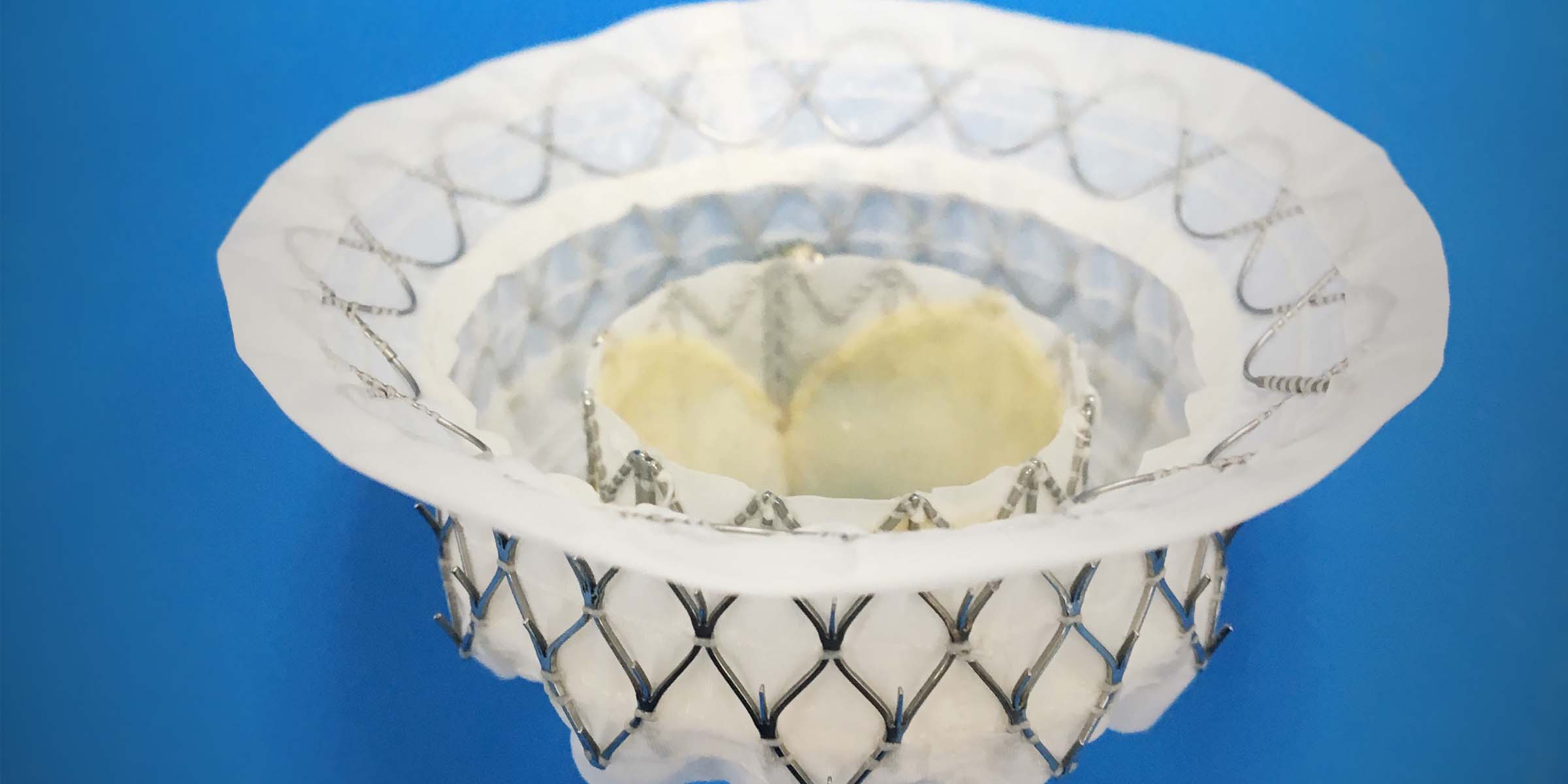 Medtronic receive FDA nod for feasibility trial of its Intrepid