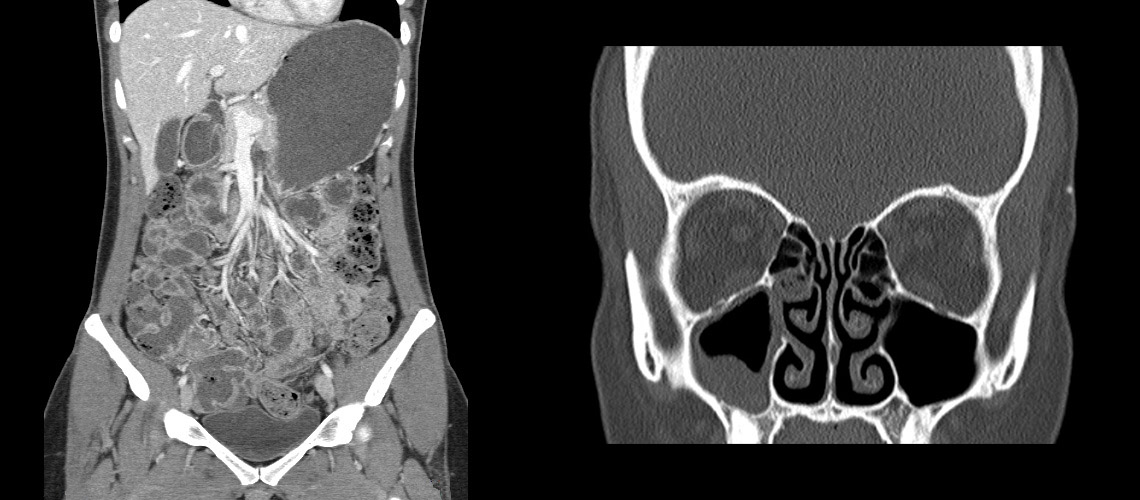 CT Scans Big Sky Diagnostic Imaging