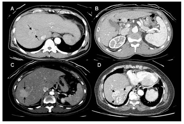 Biomedical Imaging and Intervention Journal