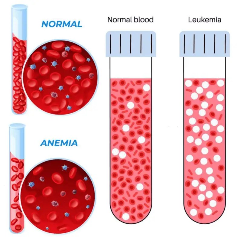 How A Routine CBC Test Could Save Your Life? BioReach