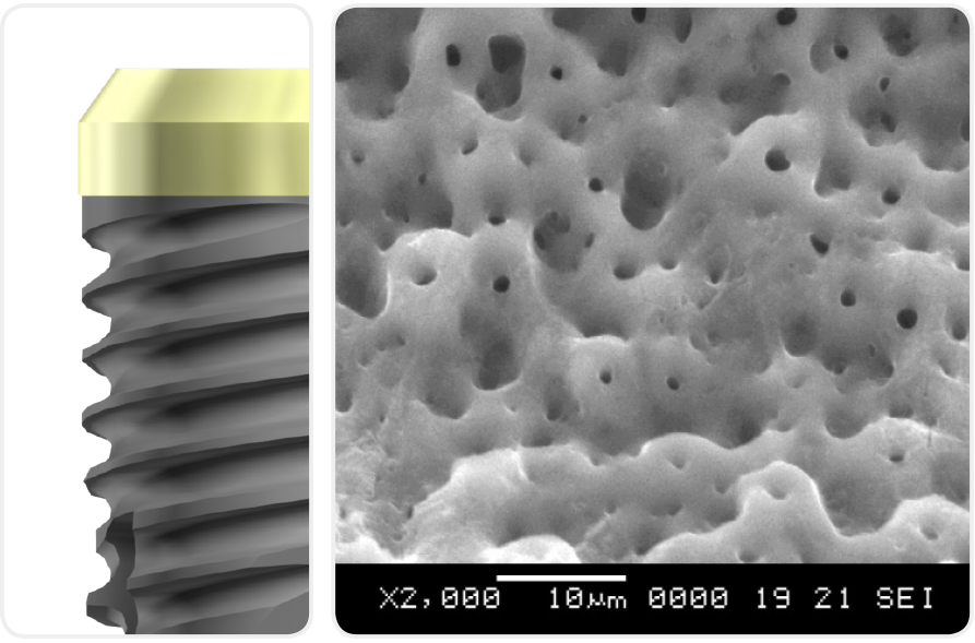 Implants Biodenta Your Total Solution Provider