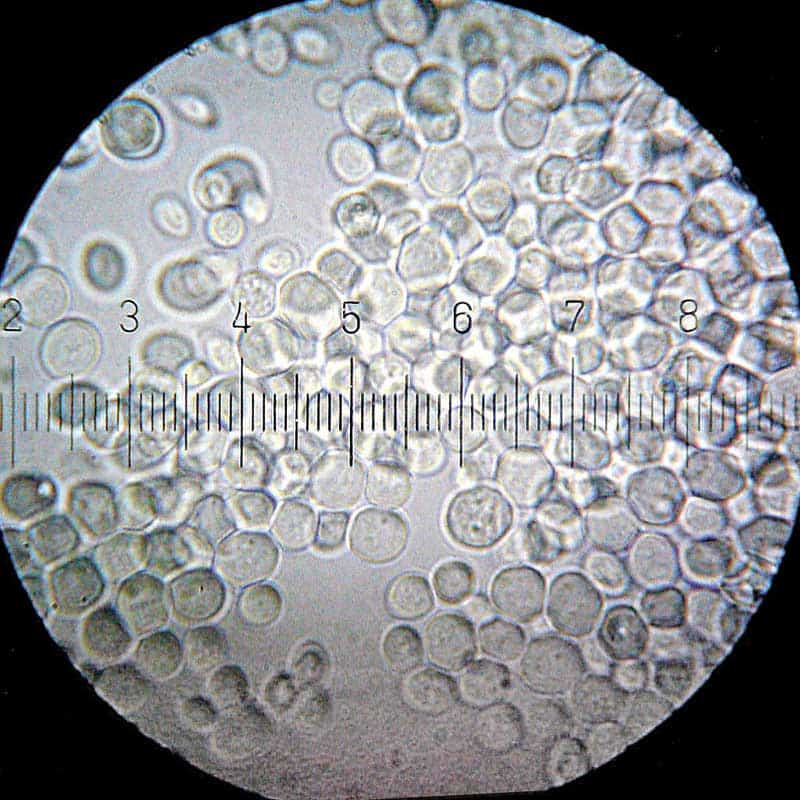 What is Yeast? | Yeast Studies | BioExplorer.Net