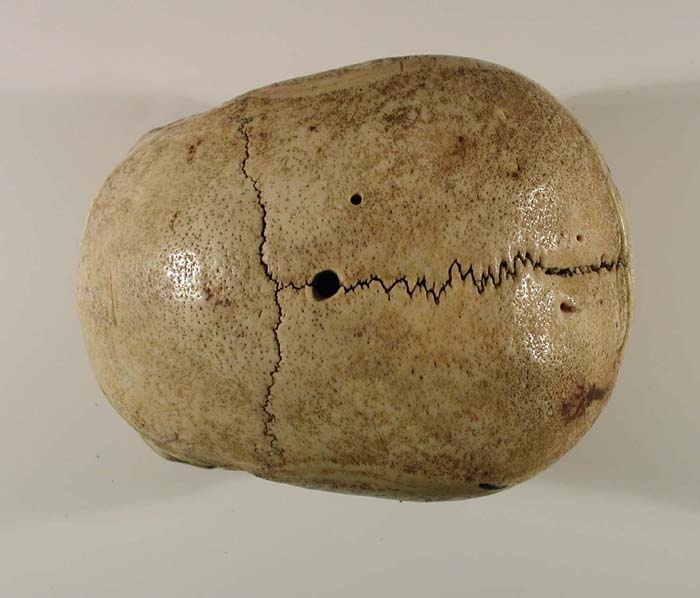 The SkullsDetermining Age JacquesScience