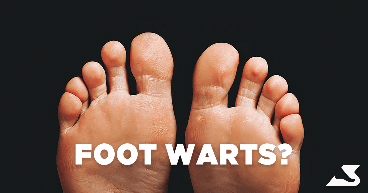 What Are Foot Warts & How To Tell If It's A Corn BioPed Footcare
