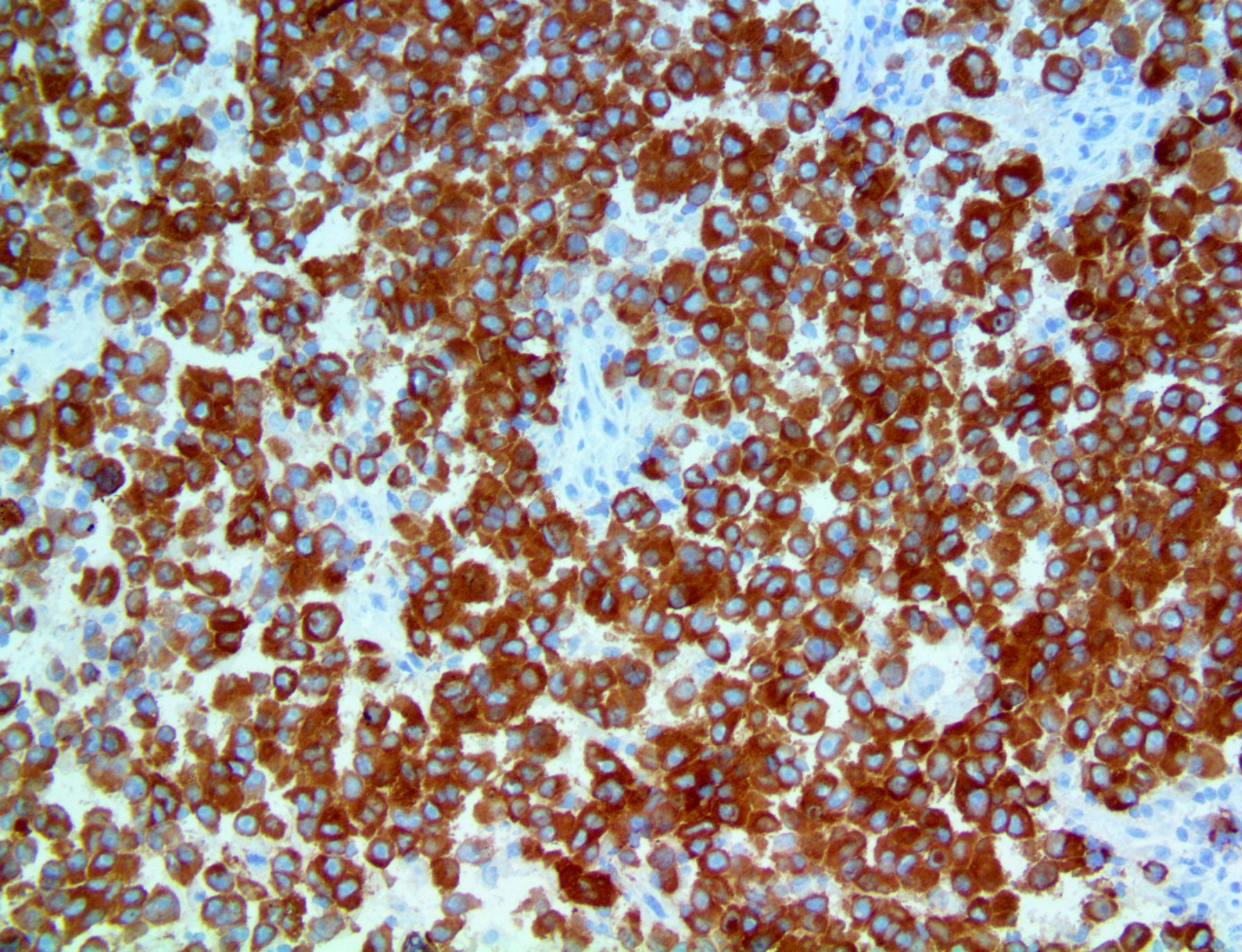 Mohs PolyDetector DAB HRP Brown IHC Detection System Bio SB