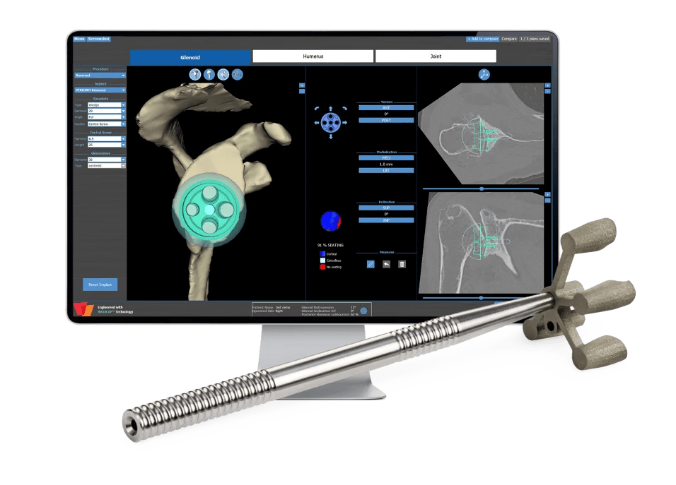 Stryker introduces Tornier shoulder arthroplasty portfolio in India