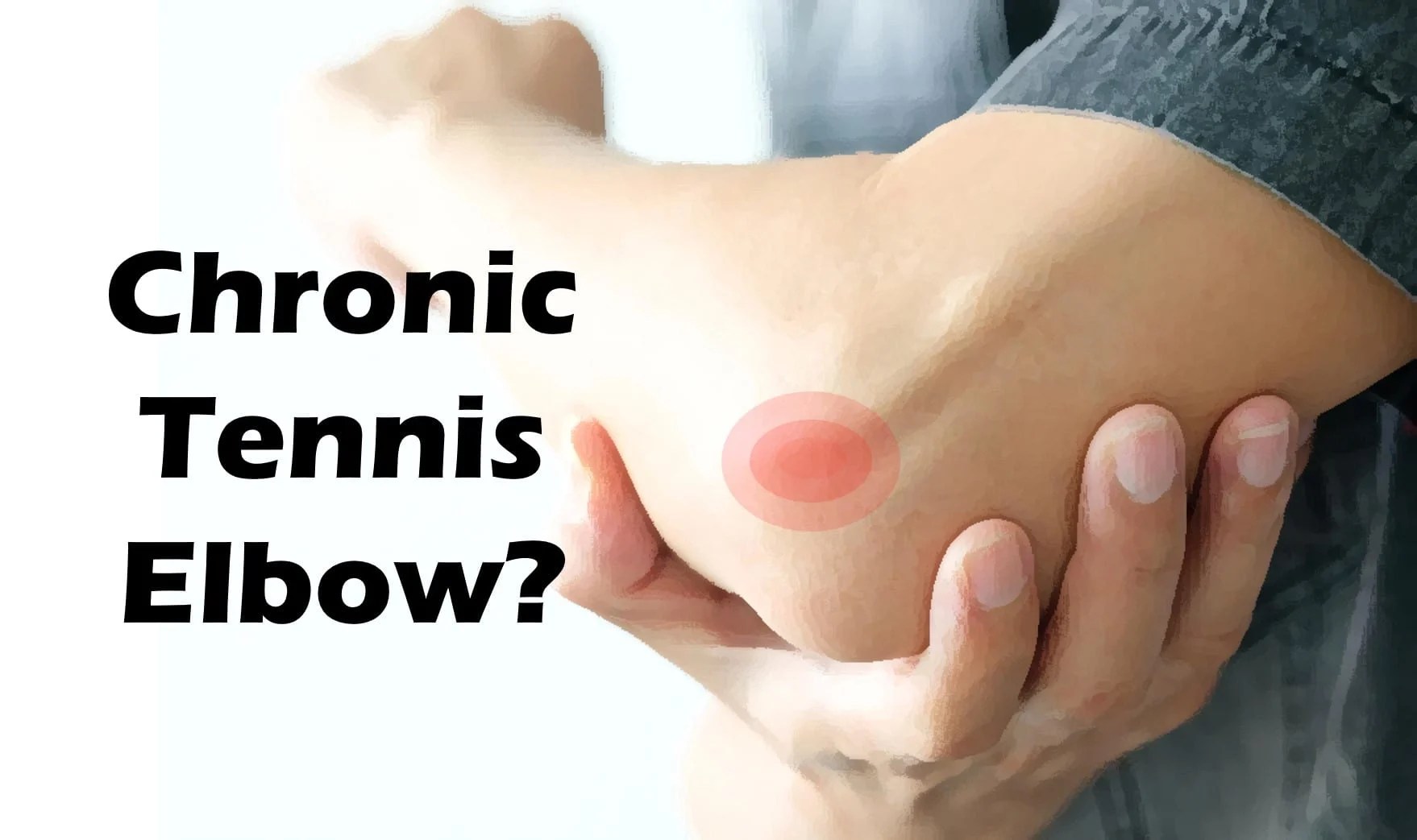What is Tennis Elbow and How It Can Be Treated BioXcellerator