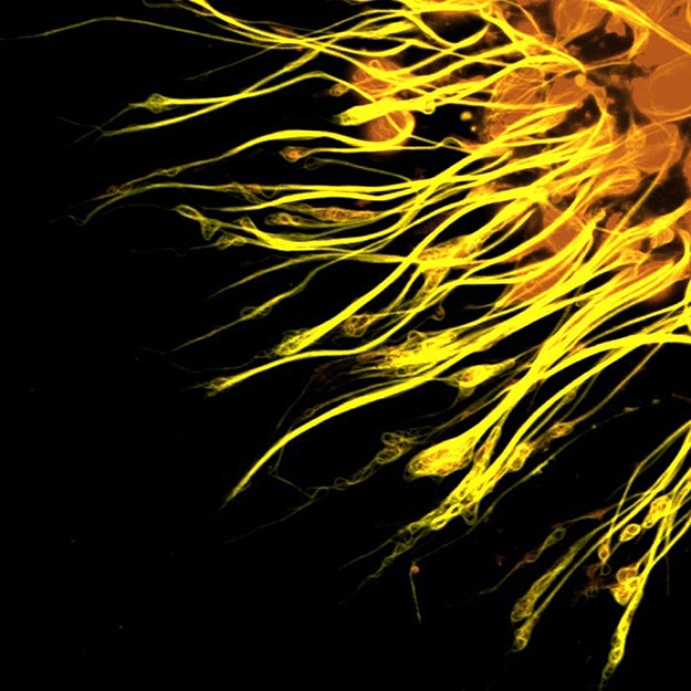 Geek Alert Brain Cells Under A Microscope! Bit Rebels