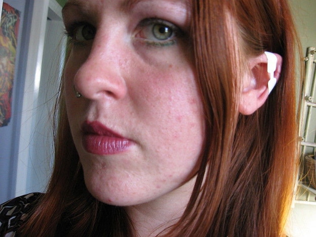 Dedicated Geeks Go All Out To Get Elven Ears Bit Rebels