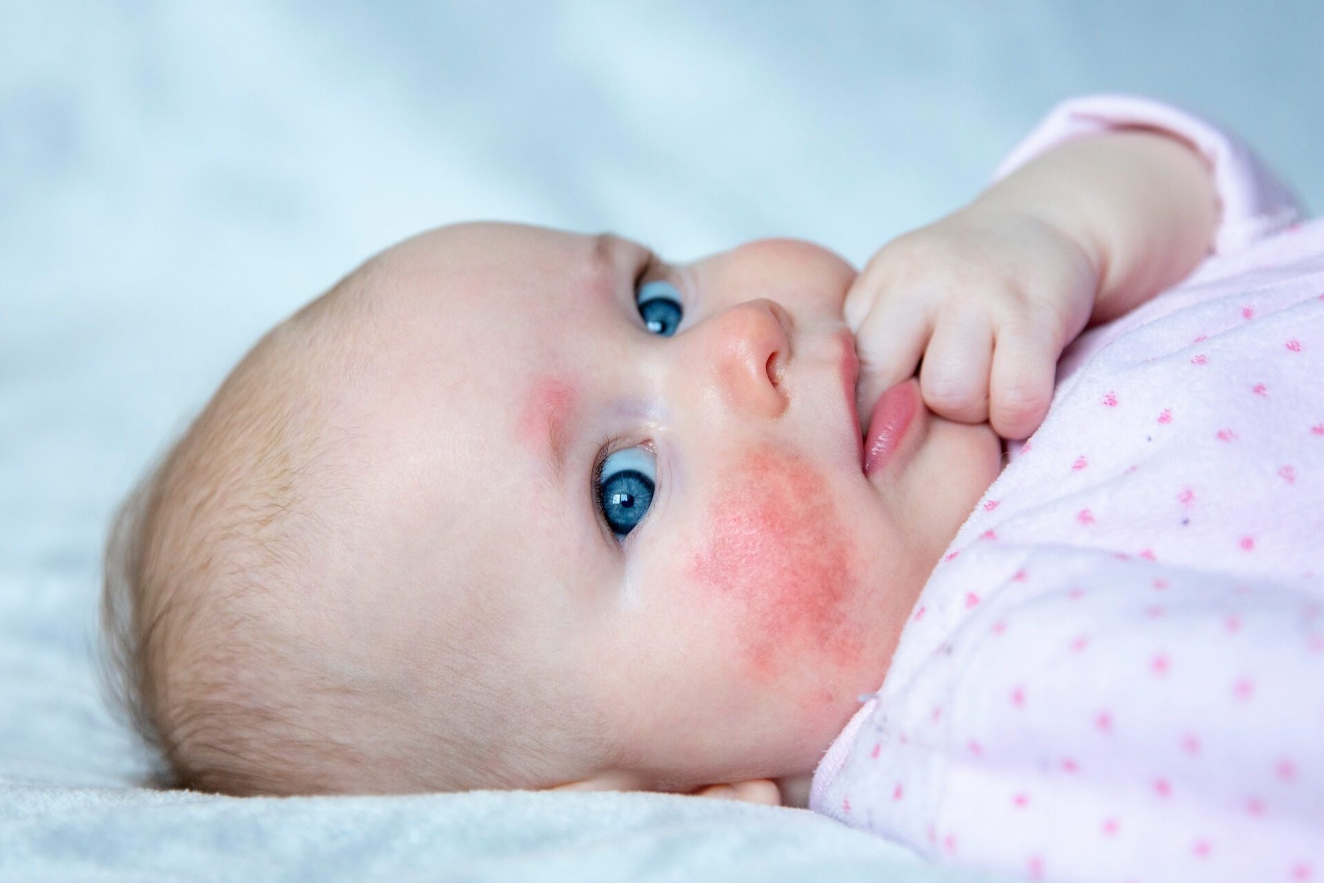 Home Remedies for Baby Rash Natural Solutions for Your Little One's