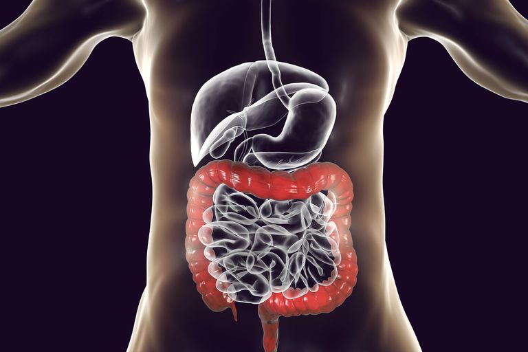 Ulcerative colitis natural cure Archives Dr. Vikram Chauhan's Blog