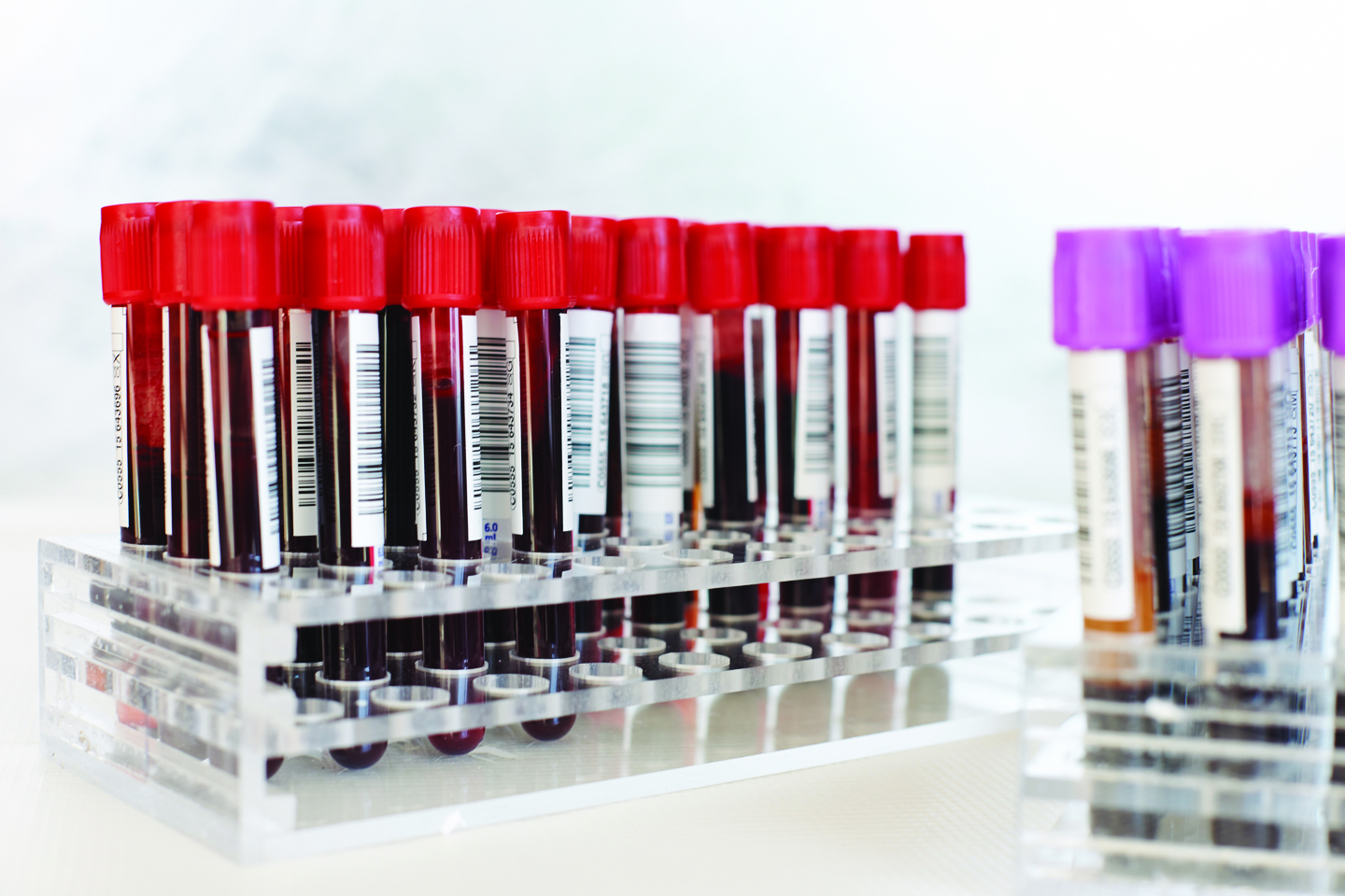 Whole Blood Canadian Blood Services