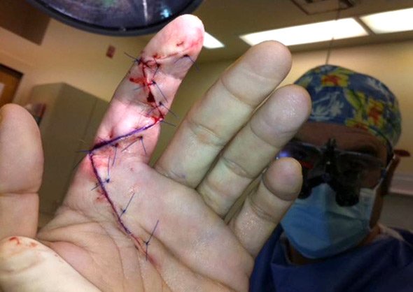 Infections Duty Knife Cuts Are Serious