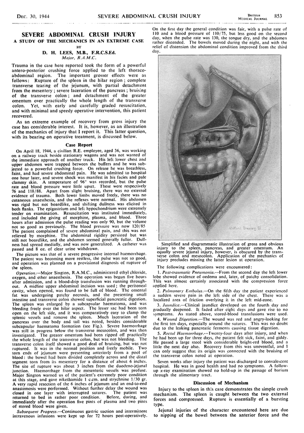Severe Abdominal Crush Injury The BMJ