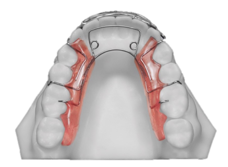 Hawley Retainer With Springs