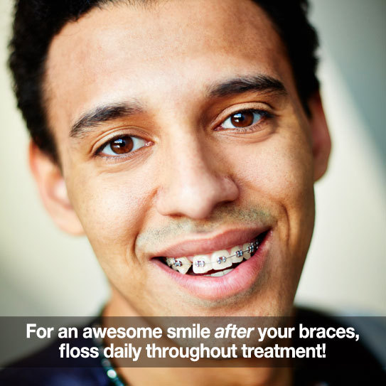 Some Important Tips For Flossing With Braces