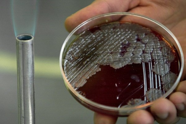 Doktorlara şarbon teşhisi yasağı mı geldi Borsatek
