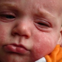 Voedselallergie Bij Zuigelingen - Borstvoeding