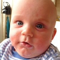 Voedselallergie Bij Zuigelingen - Borstvoeding