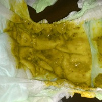 Ontlastingspatroon Van Borstgevoede Baby's - Borstvoeding