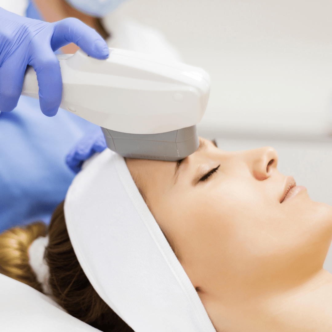 Botox Long Island What Can IPL Lasers Remove?