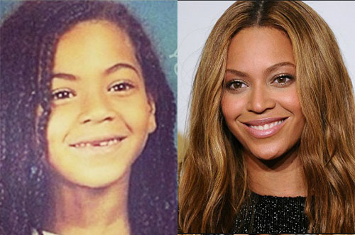 Celebrities that were not great looking as children Page 2 of 13 news