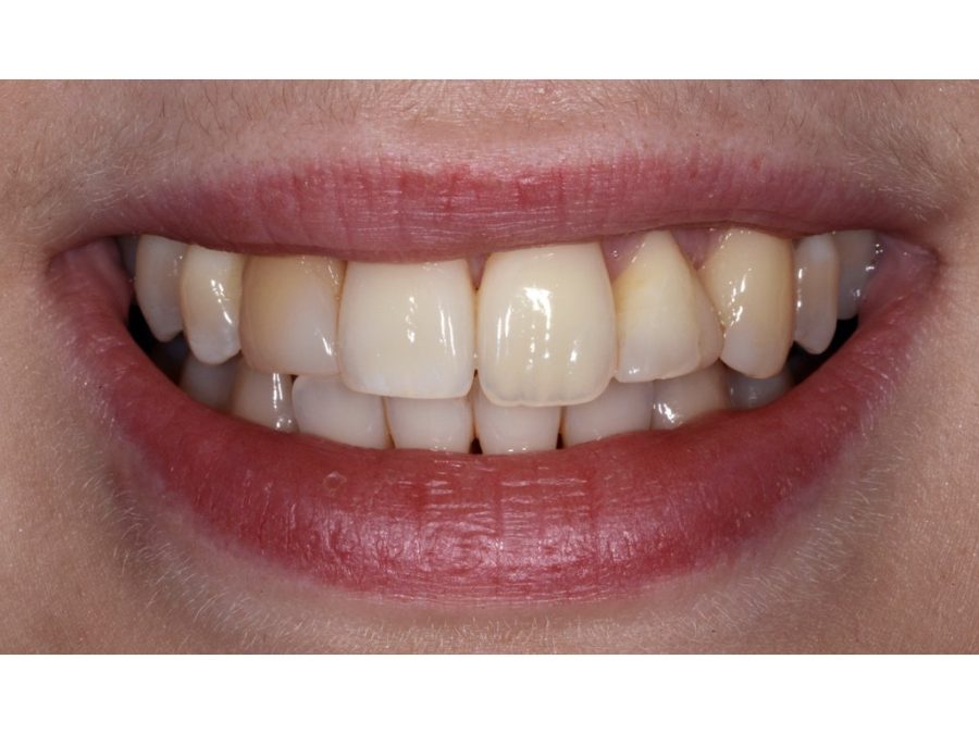 Fixed & Removable Prosthodontics BPI Dental