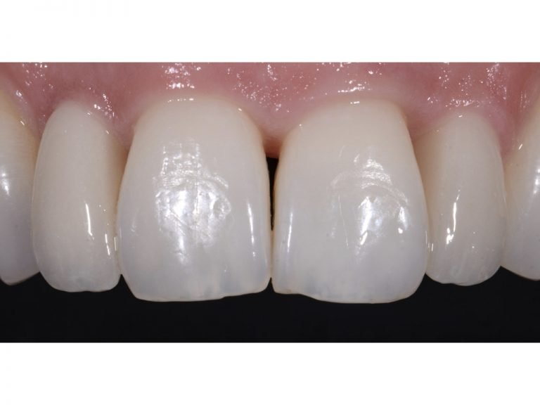 Fixed & Removable Prosthodontics BPI Dental