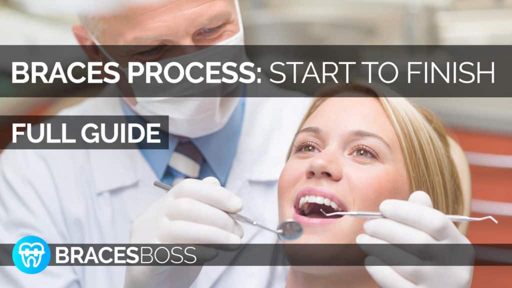 Braces Process Full Pro Guide 2023 BracesBoss