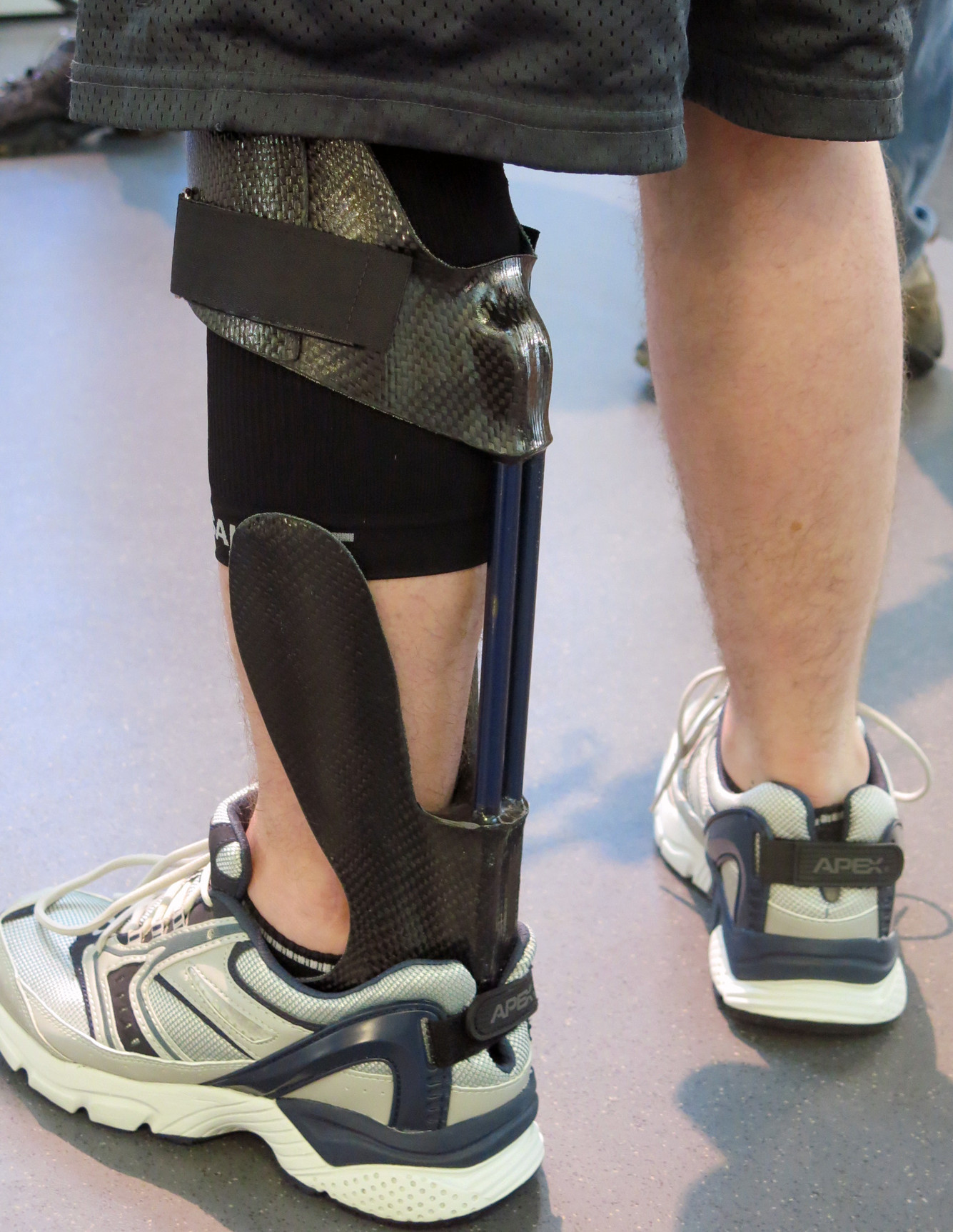 Orthotic brace helps New England farmer live without pain Braceworks