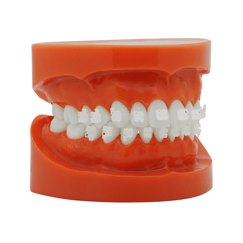 Cheap orthodontic ceramic bracket (FREE UK Shipping)
