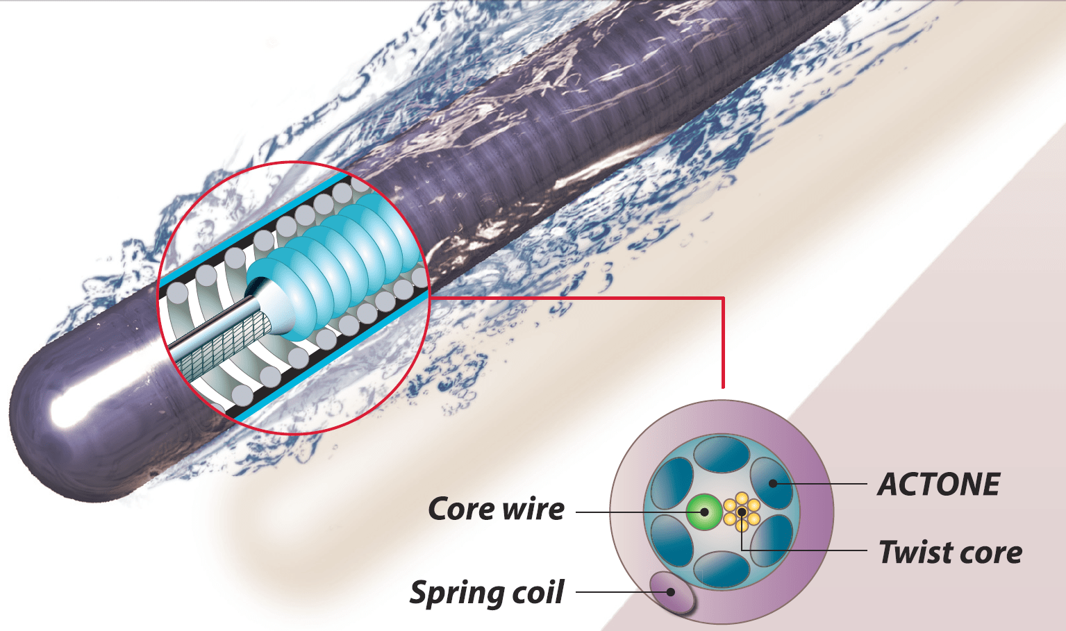 Asahi GUIDE WIRES TECHNOLOGY Brage Medical