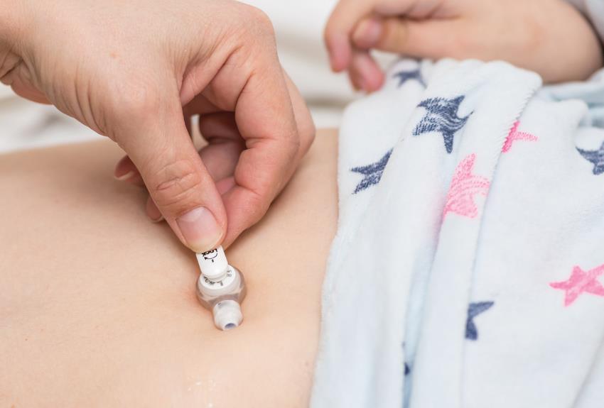 How Do Feeding Tubes Work?